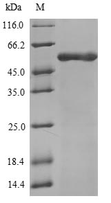 Human ATP5B protein