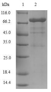 Viral ODC1 protein