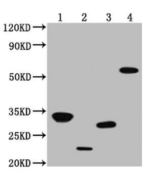 V5 Tag Antibody