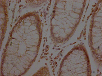 ACTB Antibody