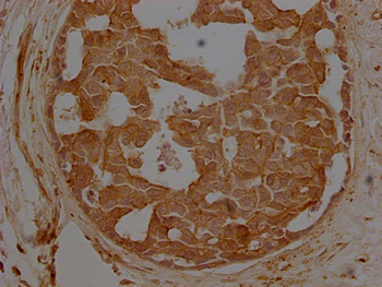 ACTB Antibody