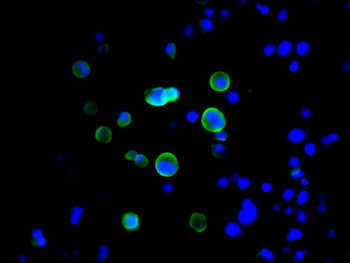 GST Tag Antibody