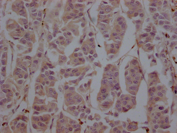 TUBB Antibody