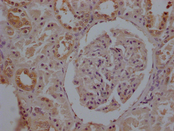 TUBB Antibody