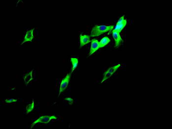 TUBB Antibody