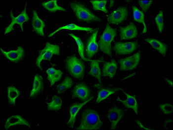 TUBB Antibody