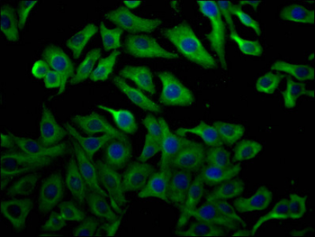 TUBB Antibody