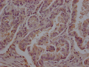 TUBB Antibody