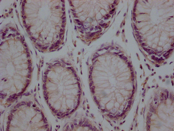 TUBB Antibody