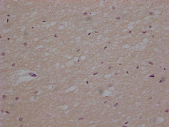 TUBB Antibody