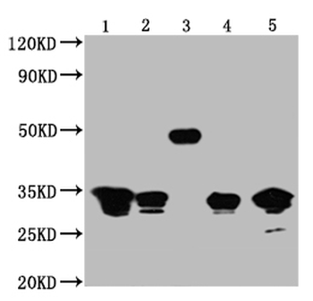 GFP Tag Antibody