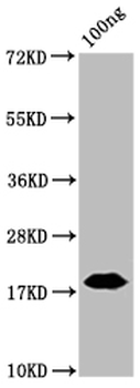 Nucleoprotein (NTD) Antibody