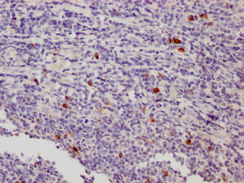 LAG3 Antibody