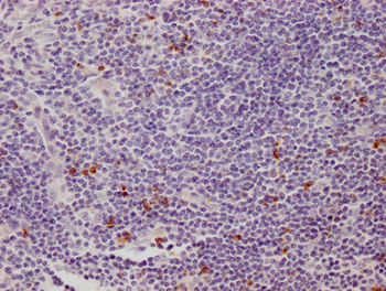LAG3 Antibody