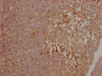 CTLA4 Antibody