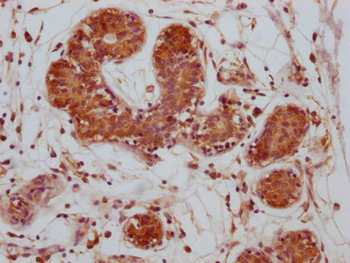 CTLA4 Antibody