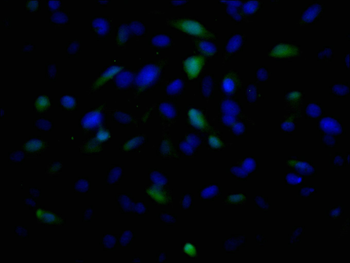 TSG101 Antibody