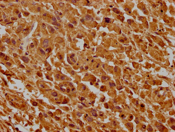 CD63 Antibody