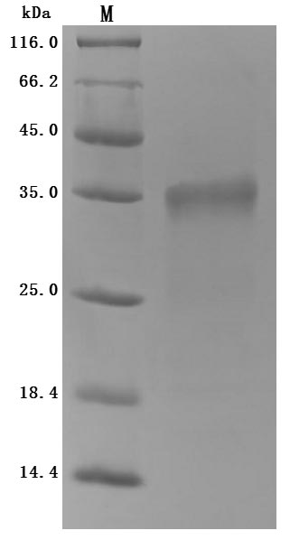 Recombinant Mouse Prolactin receptor (Prlr), partial (Active)