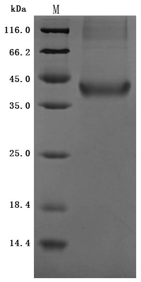 Recombinant Human Insulin growth factor-like family member 1 (IGFL1) (Active)