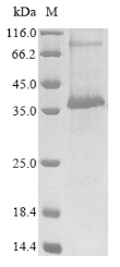 Recombinant Human Cannabinoid receptor 2 (CNR2)