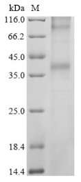 Recombinant Human Long-wave-sensitive opsin 1 (OPN1LW)
