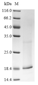 Recombinant Human Potassium voltage-gated channel subfamily E member 2 (KCNE2)