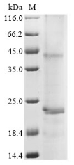 Recombinant Human TLC domain-containing protein 1 (TLCD1)