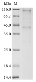 Recombinant Human Chemokine-like receptor 1(CMKLR1)