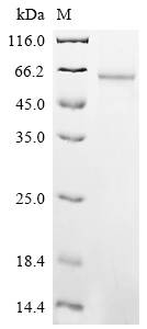 Recombinant Human Formimidoyltransferase-cyclodeaminase (FTCD)