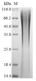 Recombinant Puccinia triticina Secreted protein (PTTG_03405)