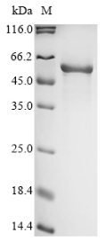 Recombinant Human Formimidoyltransferase-cyclodeaminase (FTCD)