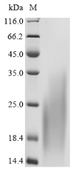 Recombinant Human C-C chemokine receptor type 8 (CCR8), partial