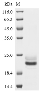 Recombinant Human E3 ubiquitin-protein ligase ZNRF3 (ZNRF3), partial