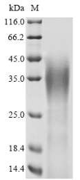 Recombinant Human Ataxin-7 (ATXN7), partial
