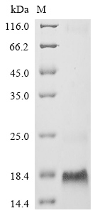 Recombinant Mouse Metallothionein-3 (Mt3)