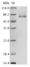 Recombinant Rat Intestinal-type alkaline phosphatase 1 (Alpi)