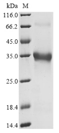 Recombinant Mouse Pro-neuropeptide Y (Npy), partial