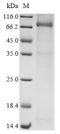 Recombinant Human Mannan-binding lectin serine protease 2 (MASP2)