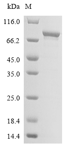 Recombinant Human HLA class II histocompatibility antigen gamma chain (CD74), partial