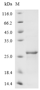 Recombinant Mouse Heme-binding protein 1 (Hebp1)