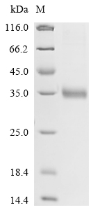 Recombinant Rat Mannose-binding protein C (Mbl2)