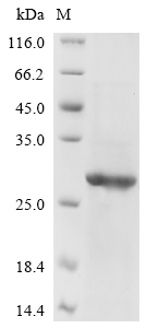 Recombinant Avian infectious bronchitis virus Spike glycoprotein (S), partial