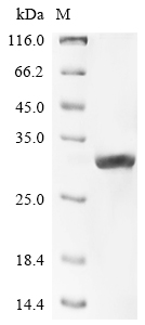 Recombinant Mouse Carbamoyl-phosphate synthase [ammonia], mitochondrial (Cps1), partial