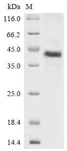 Recombinant Human Complement decay-accelerating factor (CD55), partial