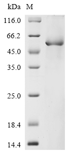 Recombinant Human Netrin-4 (NTN4), partial