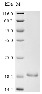 Recombinant Mouse Neuron navigator 3 (Nav3), partial