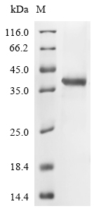 Recombinant Human Fibrillin-1 (FBN1), partial