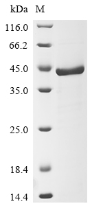 Recombinant Human Fructose-bisphosphate aldolase C (ALDOC)