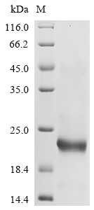 Recombinant Mouse Leukocyte cell-derived chemotaxin-2 (Lect2)